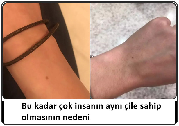 Bu kadar çok insanın aynı çile sahip olmasının nedeni